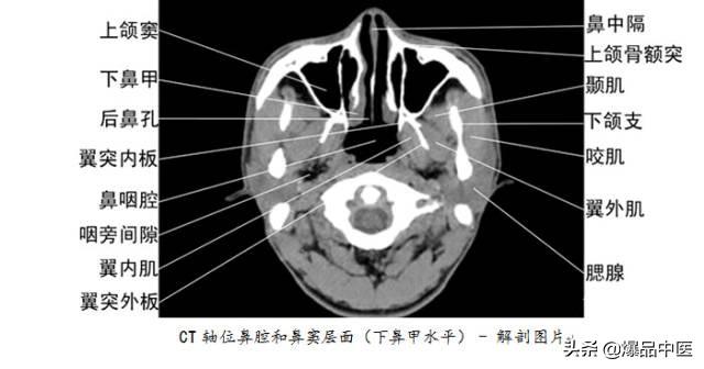 全身CT图谱