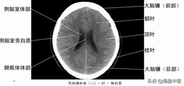 全身CT图谱