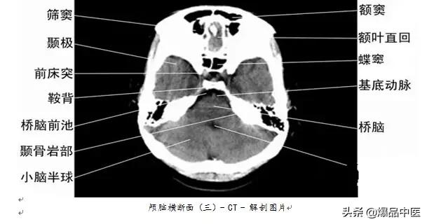 全身CT图谱