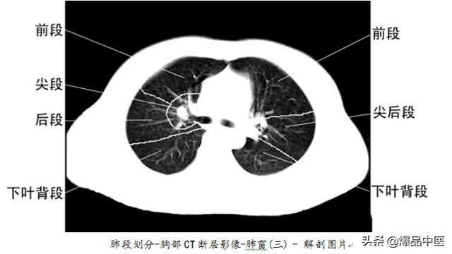 全身CT图谱