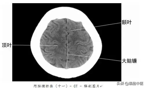 全身CT图谱