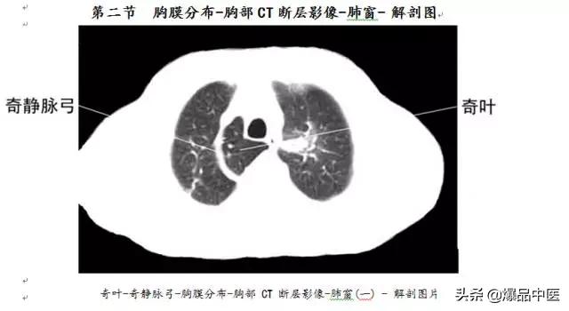 全身CT图谱