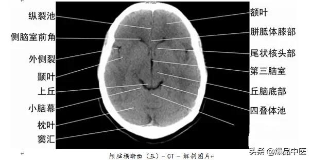 全身CT图谱