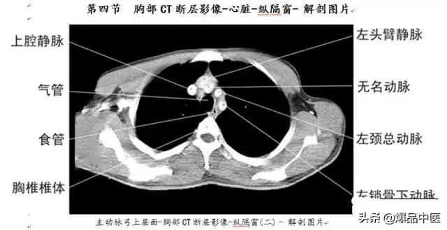 全身CT图谱