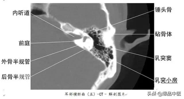 全身CT图谱