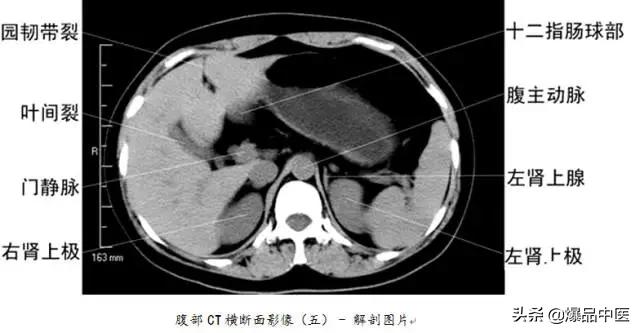 全身CT图谱