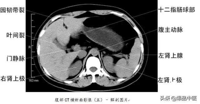 全身CT图谱