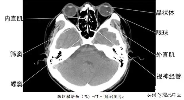 全身CT图谱