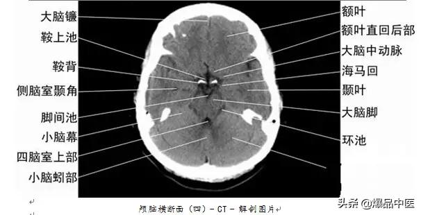 全身CT图谱