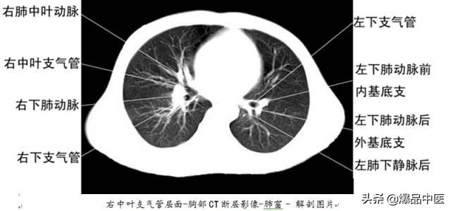 全身CT图谱