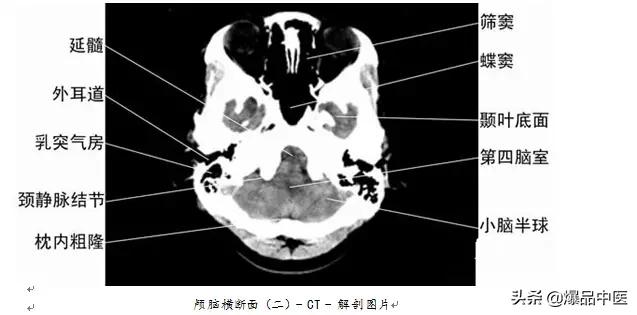 全身CT图谱