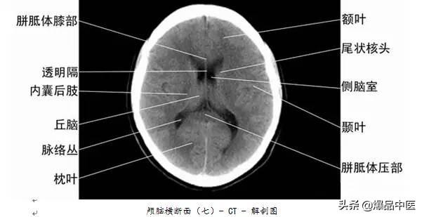 全身CT图谱