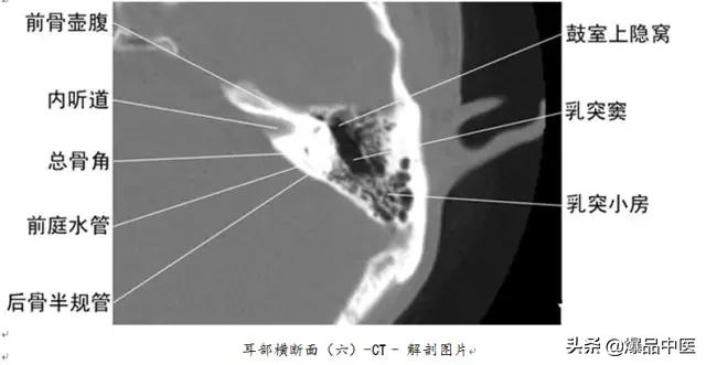 全身CT图谱