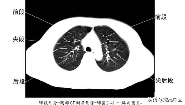 全身CT图谱