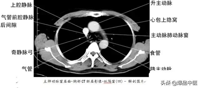 全身CT图谱