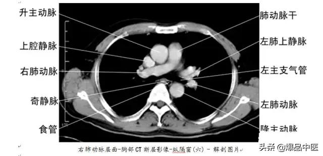 全身CT图谱