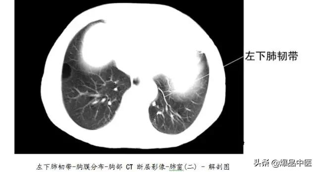 全身CT图谱