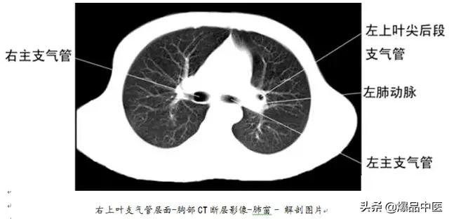 全身CT图谱