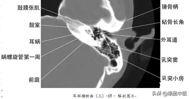 全身CT图谱