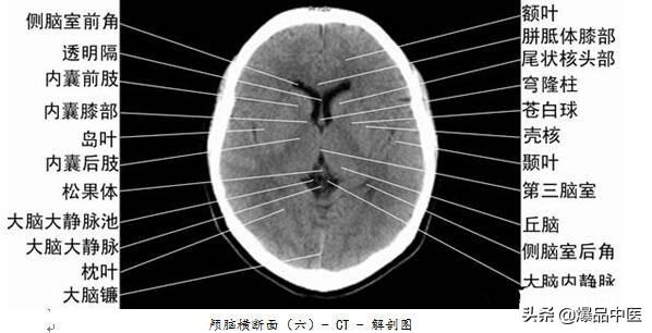 全身CT图谱