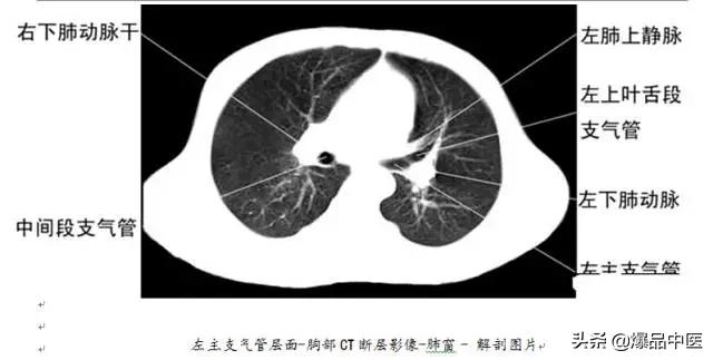 全身CT图谱