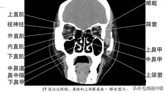 全身CT图谱