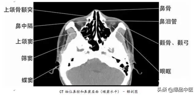 全身CT图谱