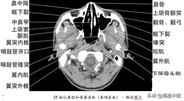 全身CT图谱