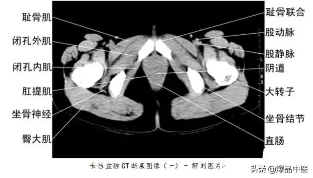 全身CT图谱