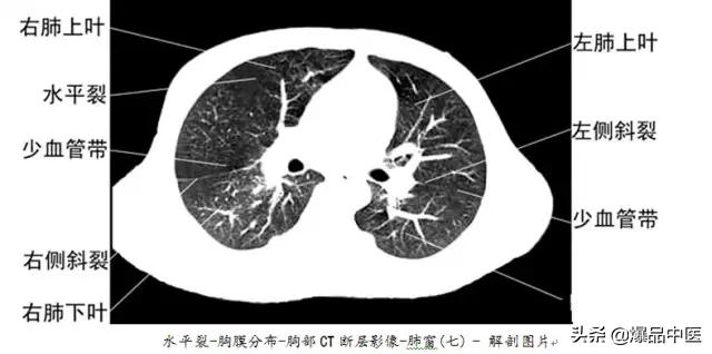 全身CT图谱