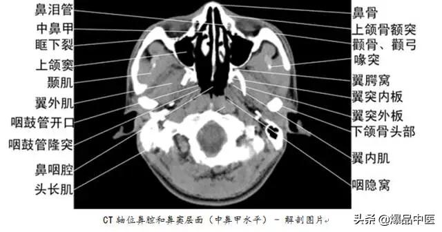 全身CT图谱