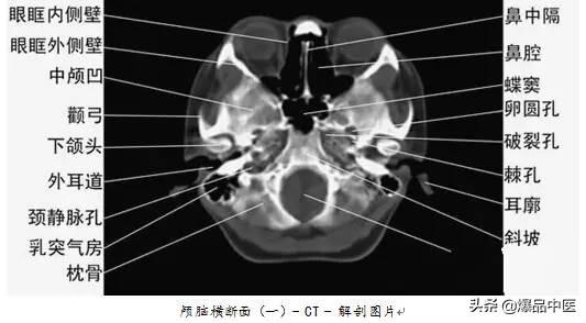 全身CT图谱
