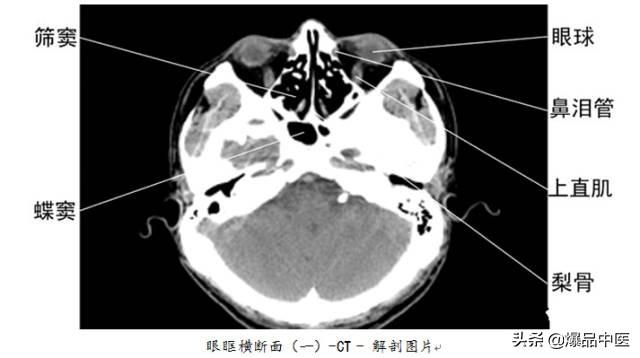 全身CT图谱