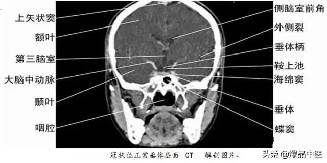 全身CT图谱