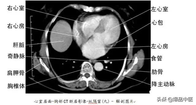 全身CT图谱