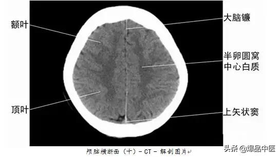 全身CT图谱