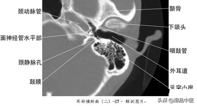 全身CT图谱