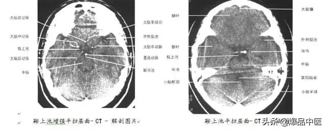 全身CT图谱