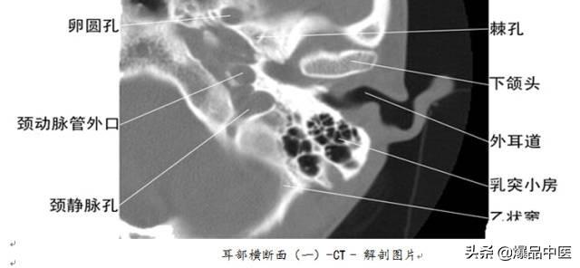 全身CT图谱