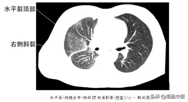 全身CT图谱