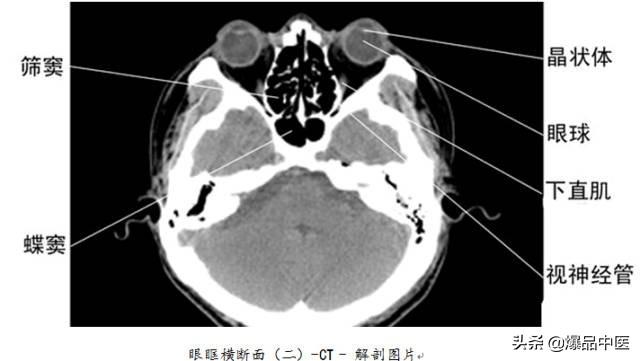 全身CT图谱