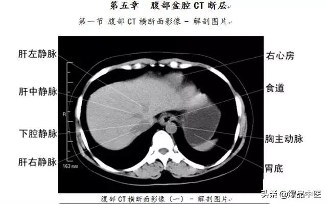 全身CT图谱