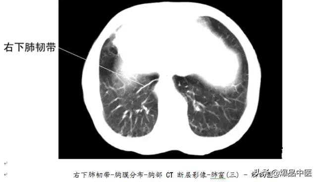 全身CT图谱