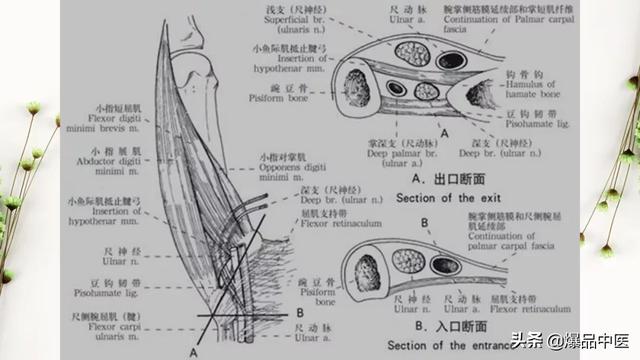 干货 | 手麻的辨构诊断