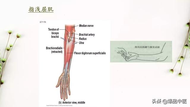 干货 | 手麻的辨构诊断