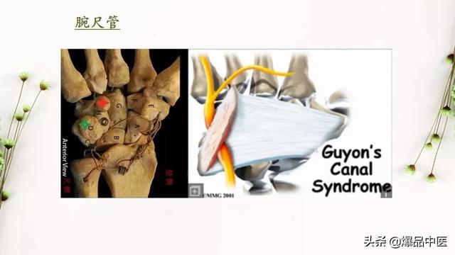 干货 | 手麻的辨构诊断