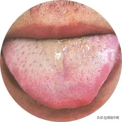 史上最全！高清舌诊图谱