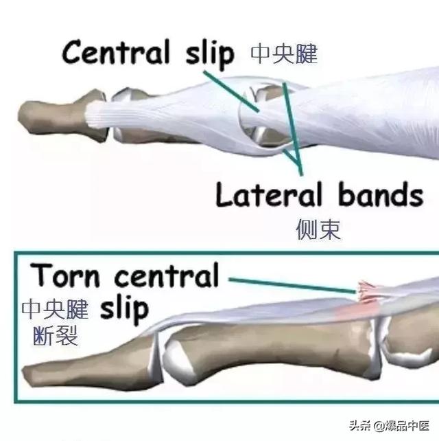 图文并茂 | 详细的手部解剖