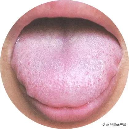 史上最全！高清舌诊图谱