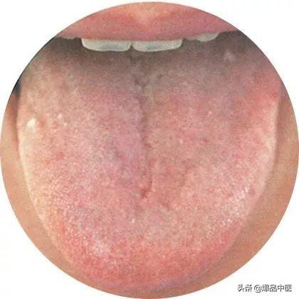 史上最全！高清舌诊图谱